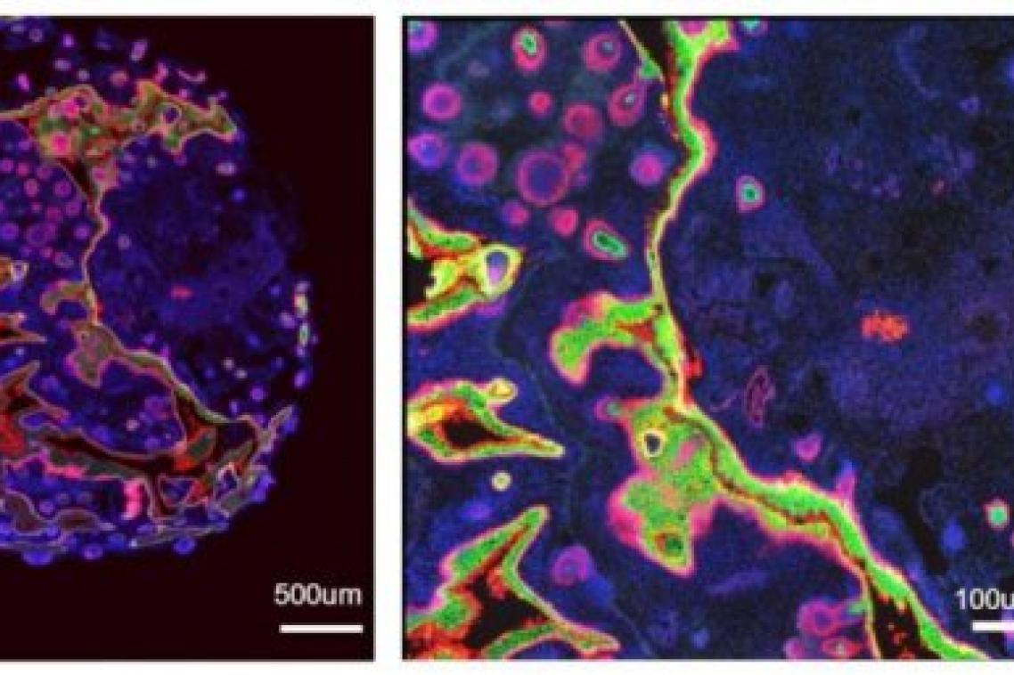 A skin organoid, stained with key human skin markers.